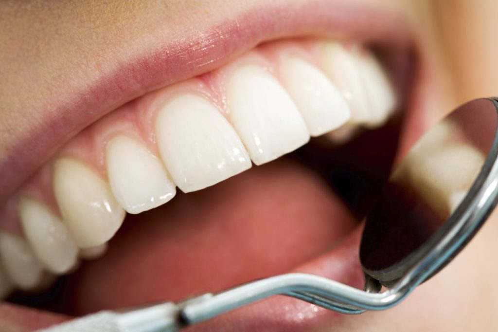 Dental health image